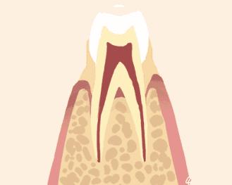 牙齿松动是什么原因,牙齿松动的原因不痒不痛小孩