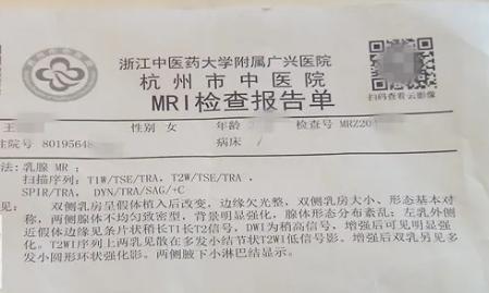 杭州姑娘做隐私部位整形，结果崩溃“帮我填的像男人一样”