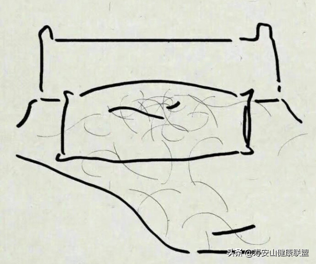 脱发联合治疗方案,脱发斑秃吃黄金搭档管用吗