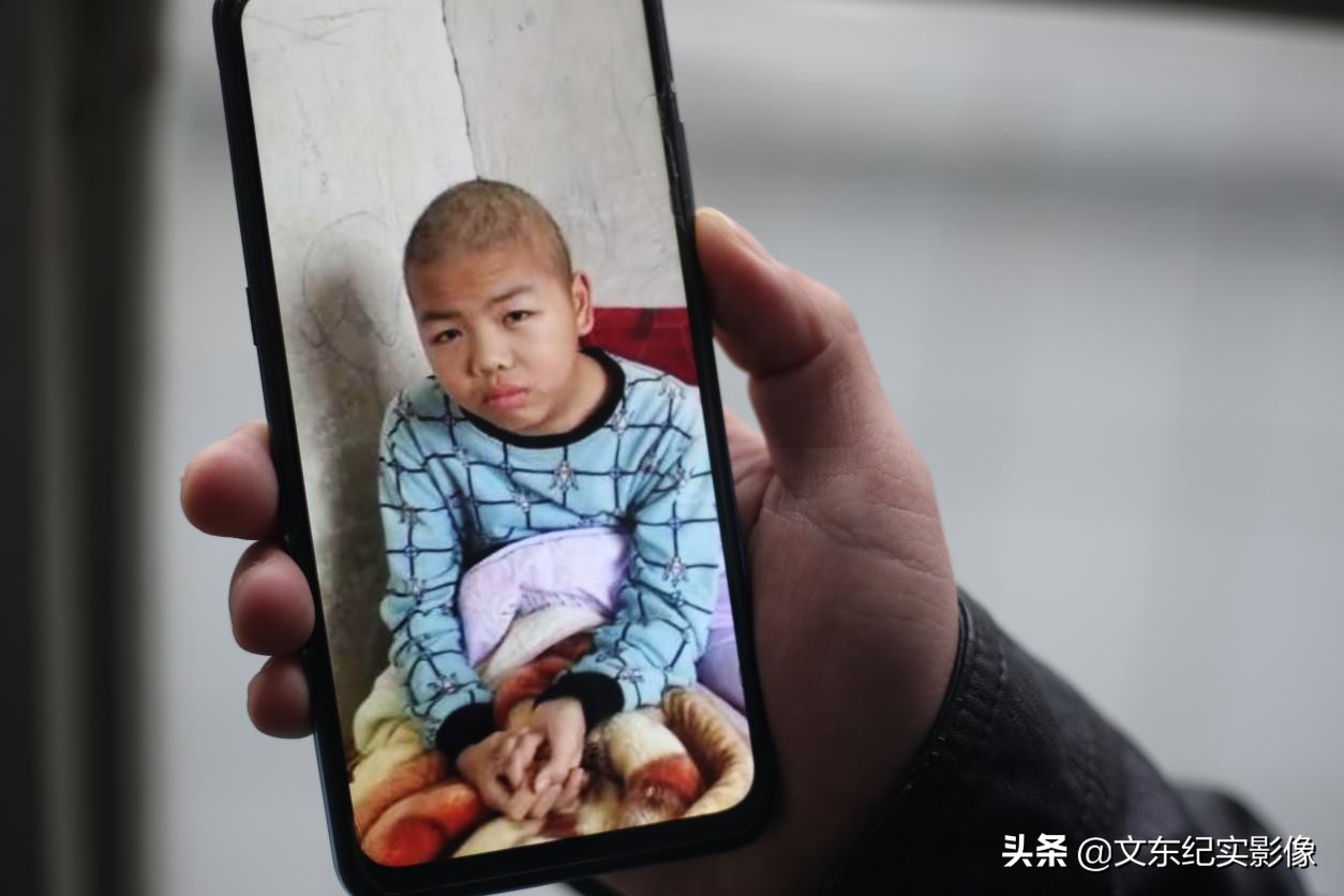 川崎病引发白血病,川崎病男孩得白血病