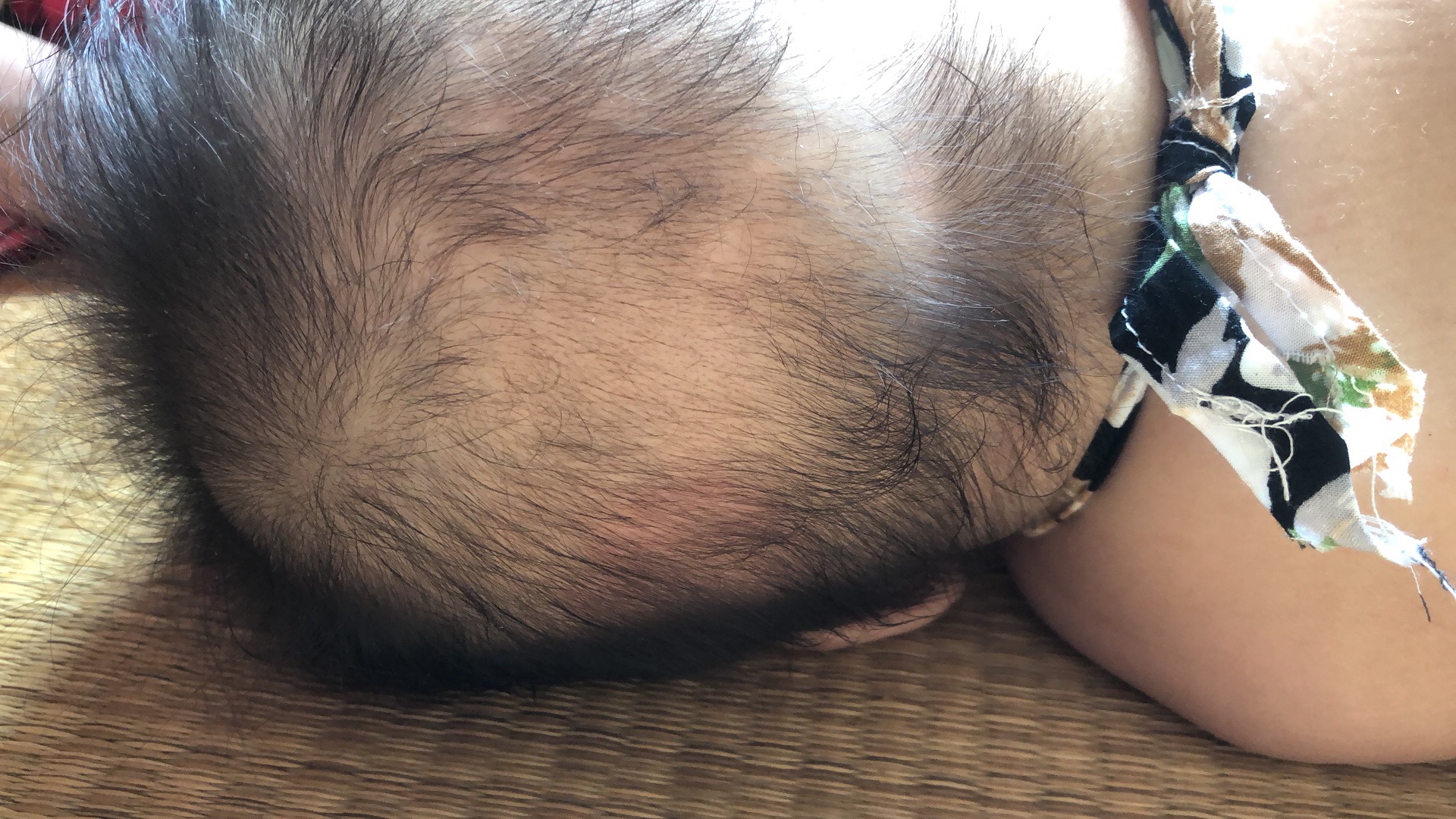 父母怎么补钙,爸妈补钙吃什么好最快最有效