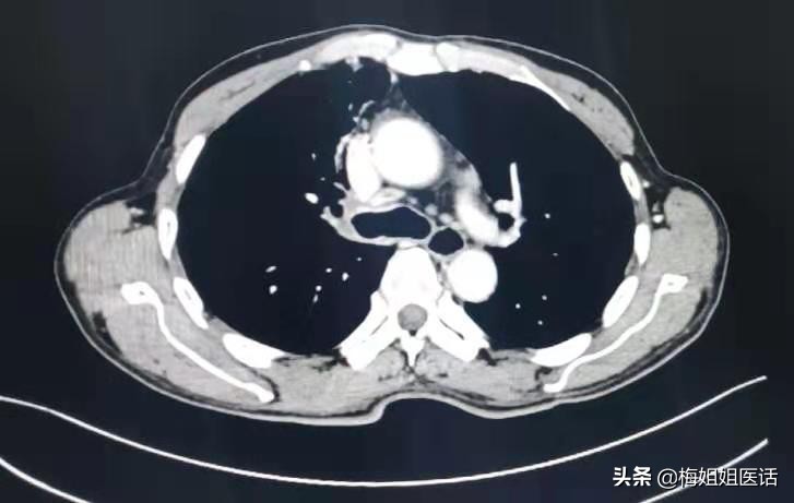 从疾病预防改为健康预防,从中医角度谈谈肿瘤的防治