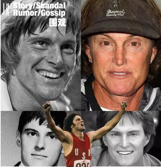 当有人说你家娃“不男不女”：严厉来侃《吹落的树叶》变性话题