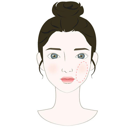 腮边长痘是什么原因,眉心长痘是什么原因