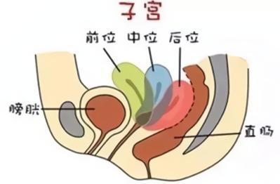 疾病科普子宫畸形如何治疗,一个正常的子宫有哪些症状
