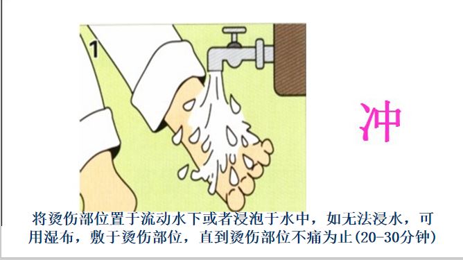 孩子烫伤记住5个字,牢记五字口诀轻松处理宝宝烫伤