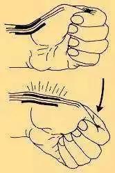 带宝宝手腕疼需要看医生吗,带孩子手腕一直痛怎么办