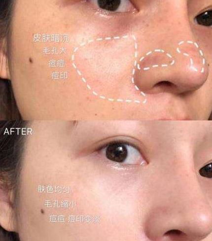 皮肤暗沉无光怎么办？不要慌！精华液不能少，让你的美更上一层楼