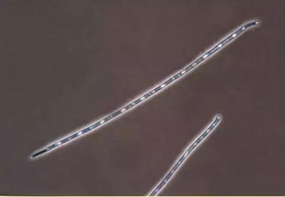 水产养殖藻类老化是怎样的,水产养殖显微镜下各种藻类