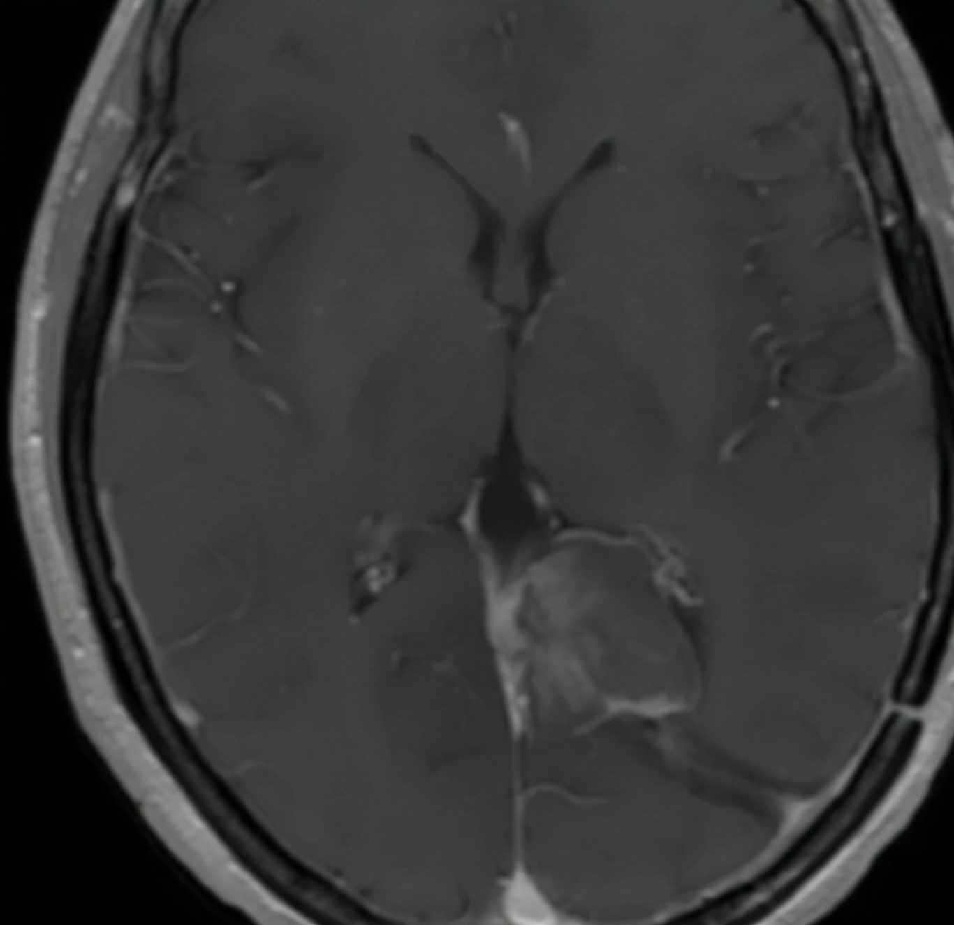 手术可能把癌细胞去干净吗,手术真能治愈癌症吗