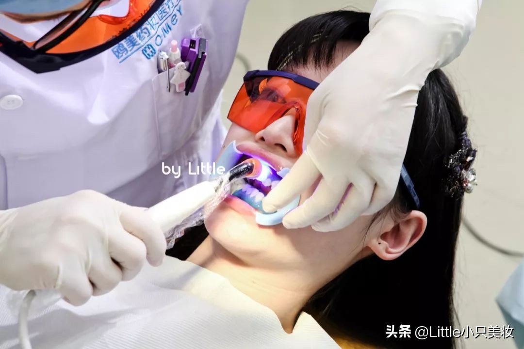 黄牙妹用什么美白,最全牙齿美白攻略