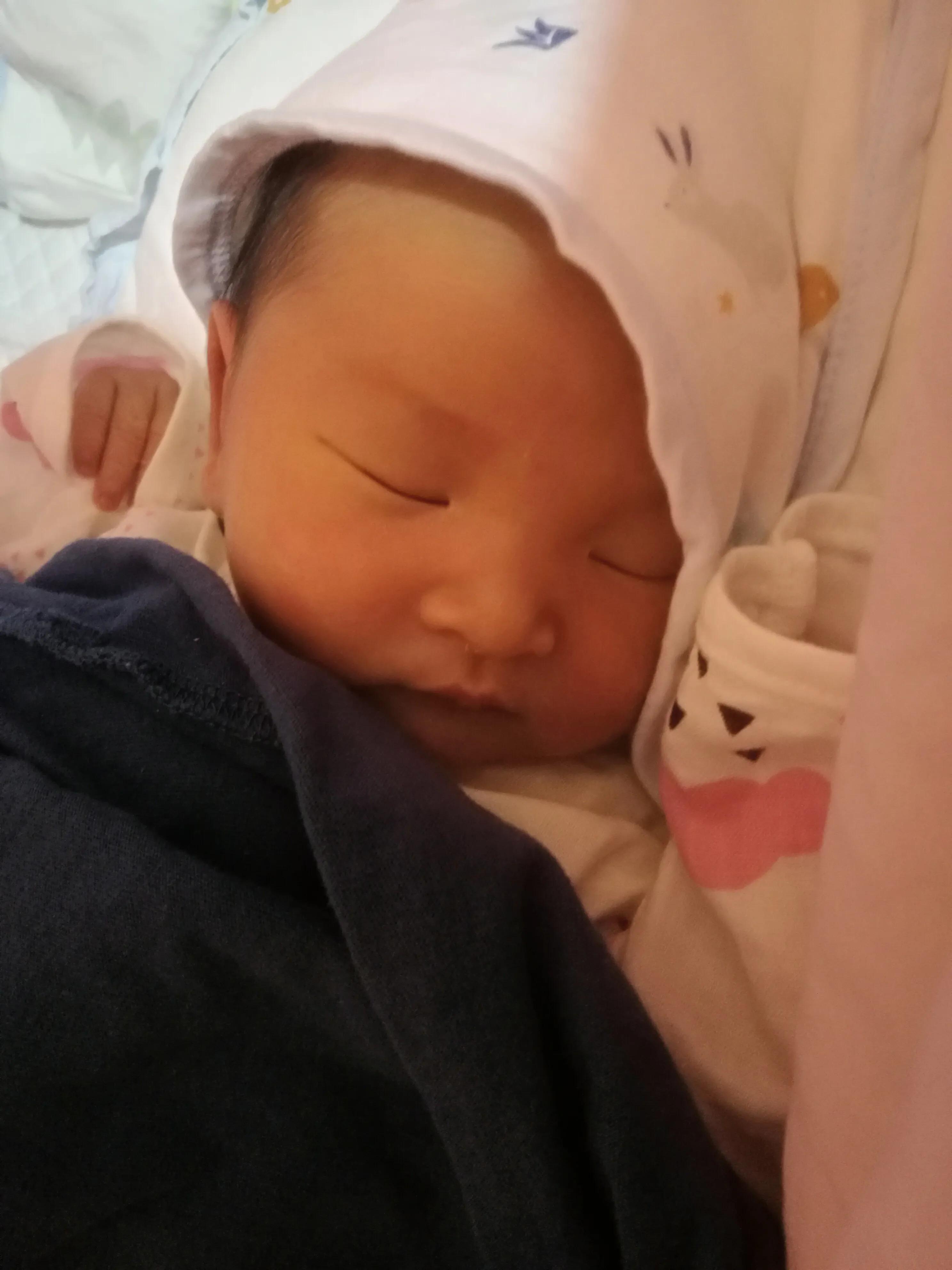 宝宝从出生要经历黄疸胀气,宝宝为什么会黄疸和湿疹