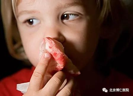 血液病病人须知：出血时该怎么办？