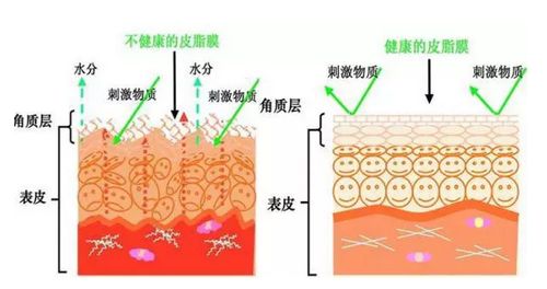 角质层薄脸上有红血丝怎么调理,角质层薄有红血丝脸发红怎么修复