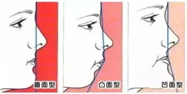 装了假牙以后还会蛀牙吗,装了假牙后可以取下来重头装吗