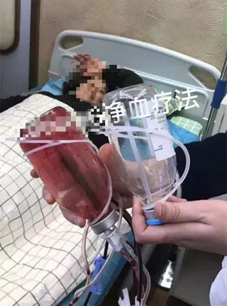 那些坑爹的网红减肥方法大揭秘,跟着女明星吃什么可以瘦