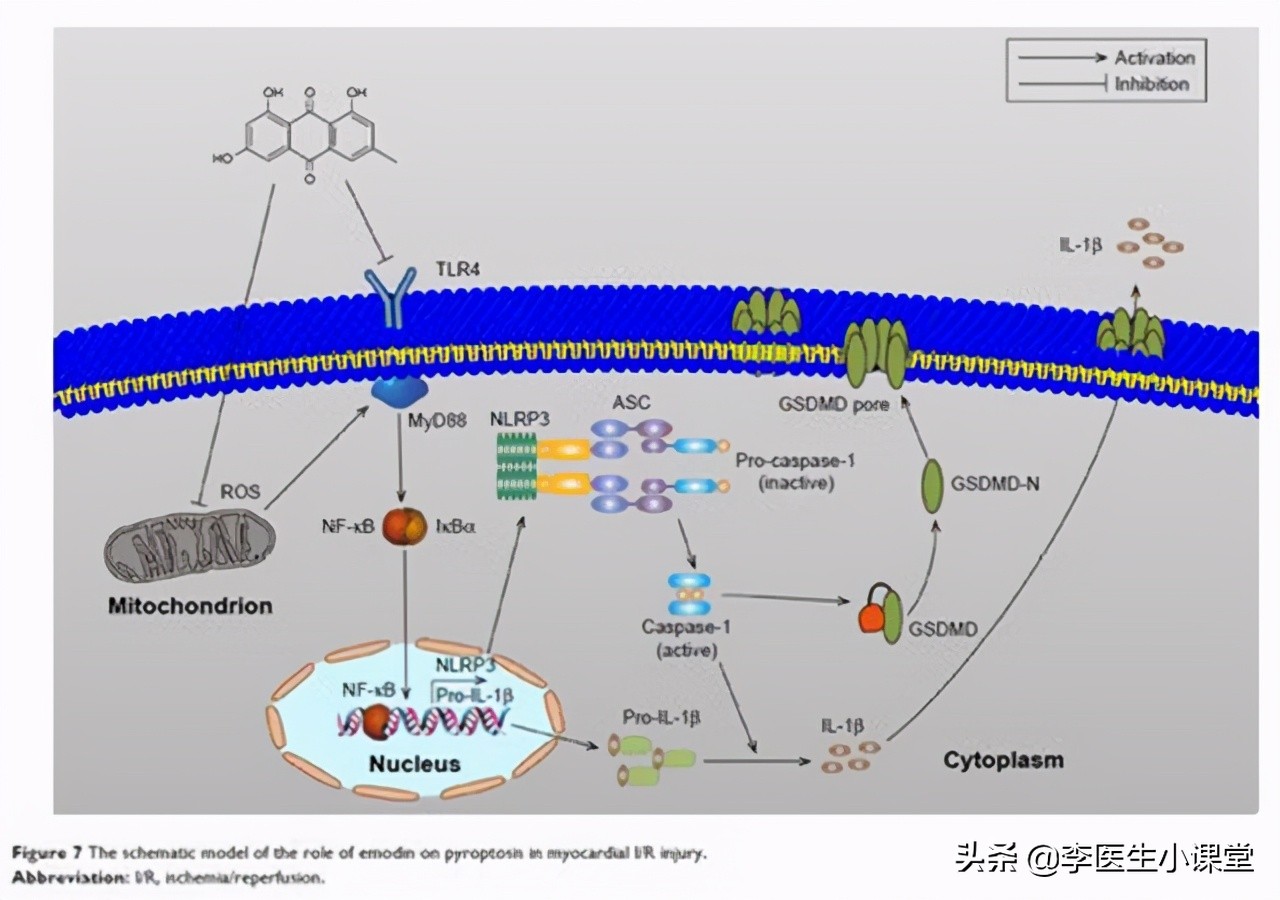 冠心病的诱发原因及症状有哪些,冠心病是怎么引起的讲解文字