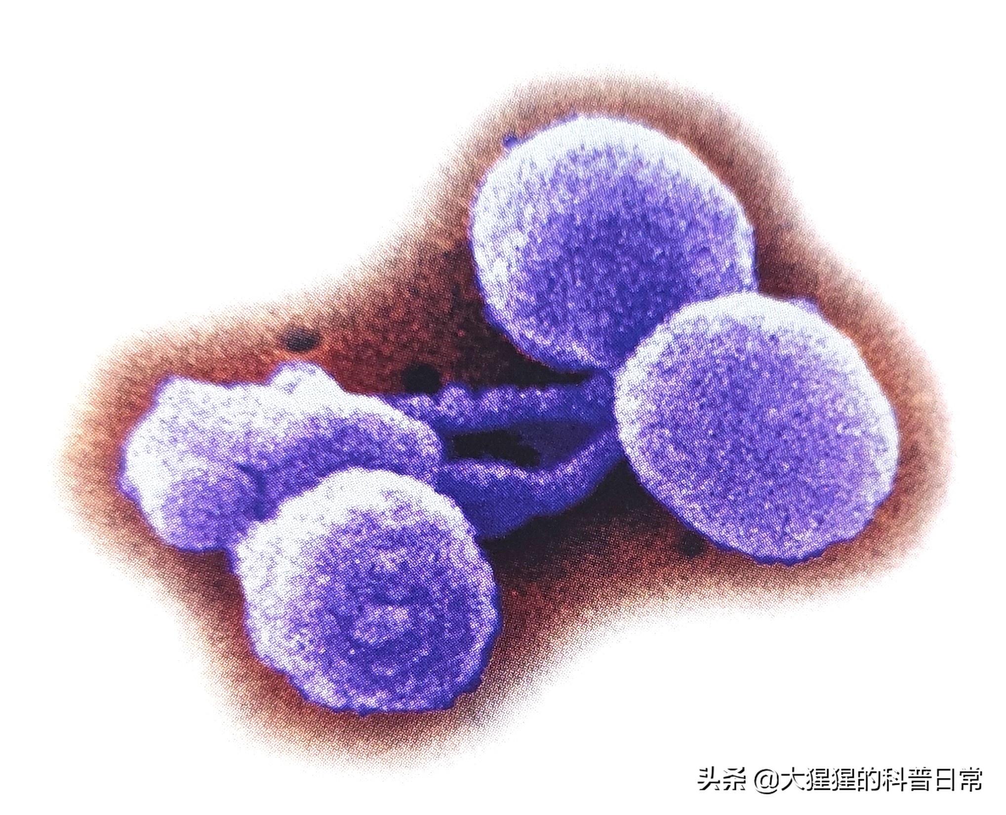 微生物原核生物,微生物照片原核生物