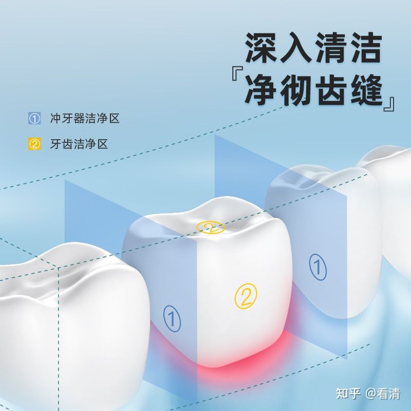 戴牙套是什么感觉,补牙后戴牙套的危害