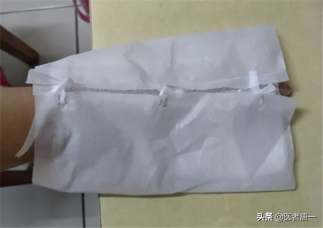 甲沟炎是不是治不好呀,甲沟炎对脚趾的伤害