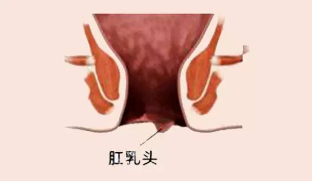 两个肉球脱出是什么痔疮,掉出肉球是痔疮吗