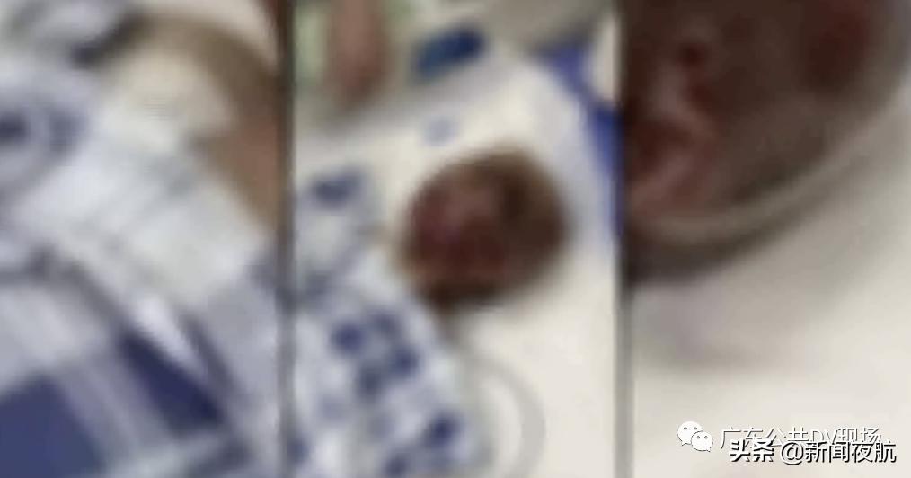 注水气球爆炸瞬间,气球充气爆炸过程