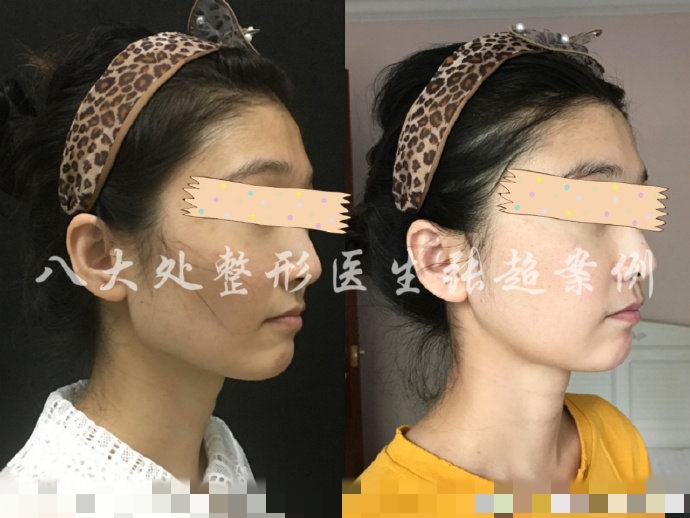 八大处张超抖音,八大处张超合集