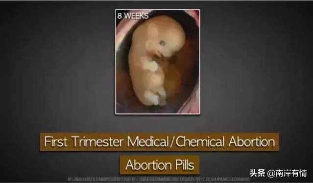 堕胎可怕吗,堕胎到底多可怕