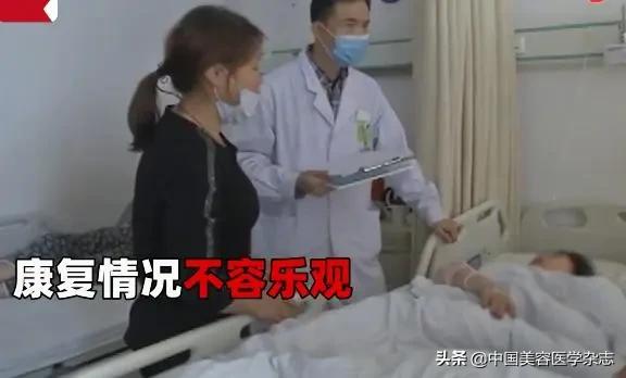 面部整形后的女孩,女人整形后抽搐死亡