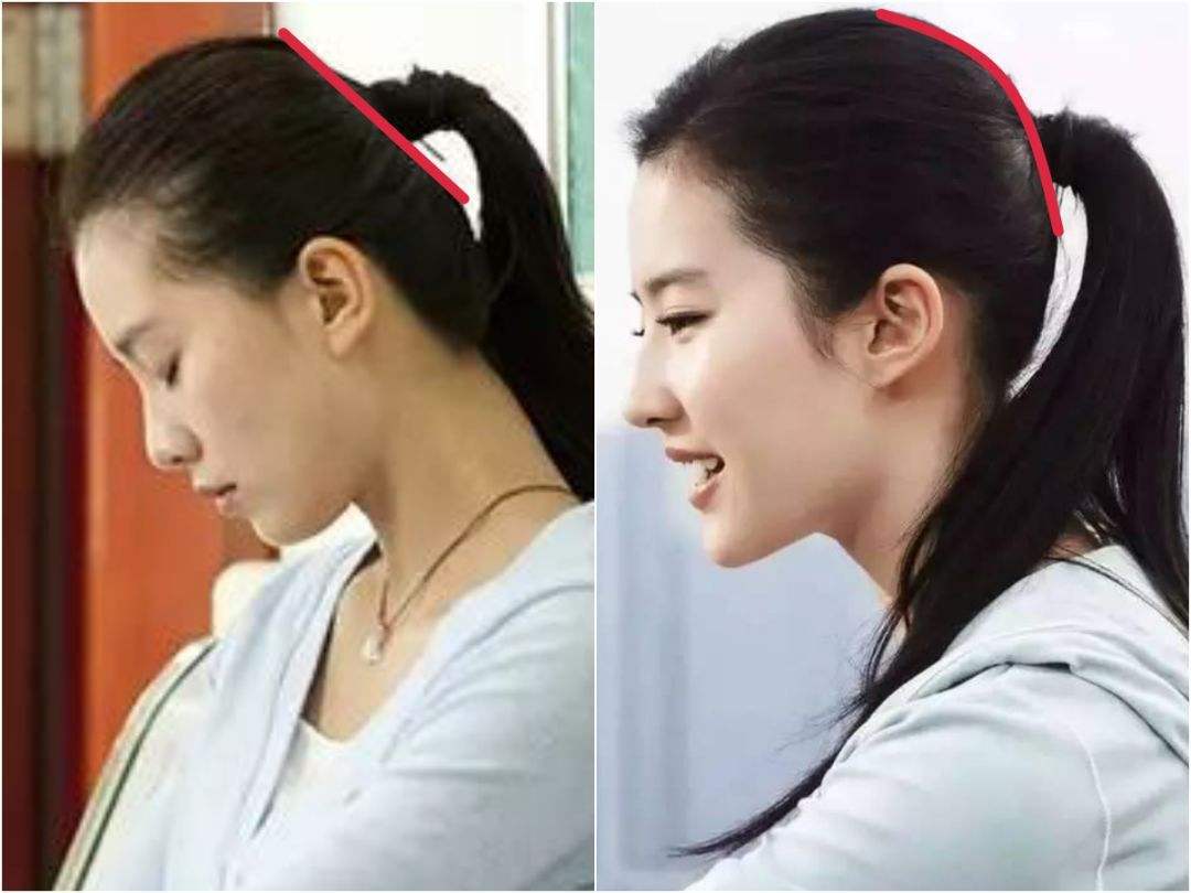 婴儿肥怎样改善,婴儿肥如何改善学生党