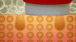 日本49岁贵妇为去皱，坚持用“开塞露”抗老长达20年，现今啥样？