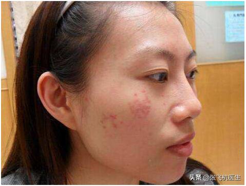 4种含叶黄素的食物是眼睛的最爱,四种易长斑的食物