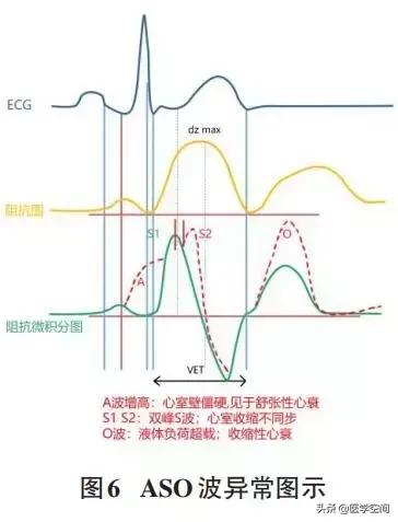心血管疾病早期心脏康复专家共识,心脏康复护理专家共识解读