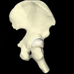 髋关节疼痛会引起腿痛吗,髋关节疼痛两腿不一样长如何康复