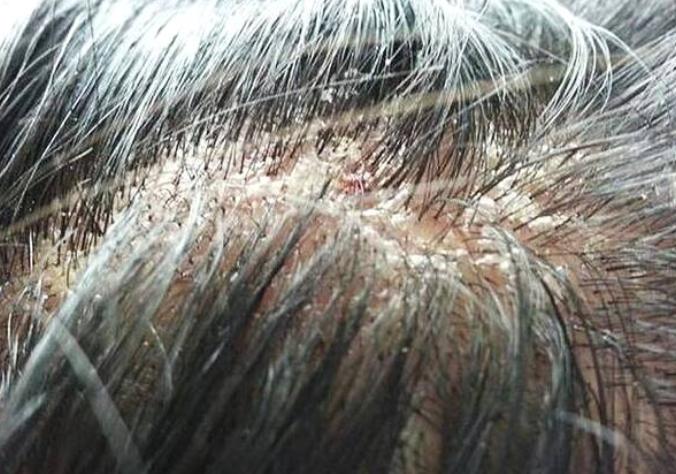 经常脱发剪短发可以缓解吗,剪短发能缓解脱发吗