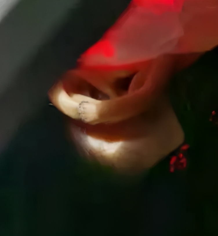 肿瘤放射治疗技术袖珍指南,肿瘤放射治疗技术改版