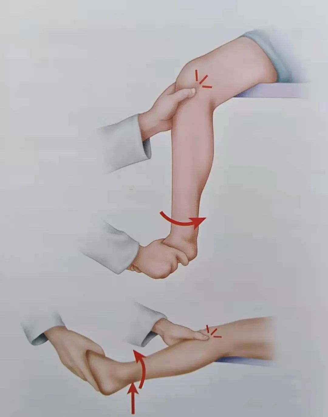 半月板损伤到底是怎么一回事,半月板后角损伤二级算严重吗