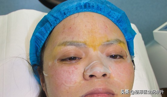 机打水光针好吗,机打水光针一般多少时间