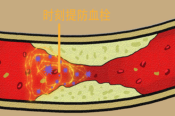 心脏病出现房颤心律失常严重吗,心脏房颤能引起休克吗