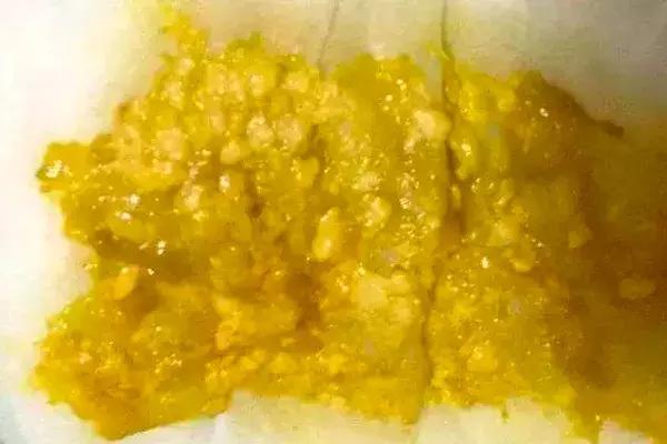 新手爸妈稳住！手把手教你看懂千姿百态大便便（超全视察指南）