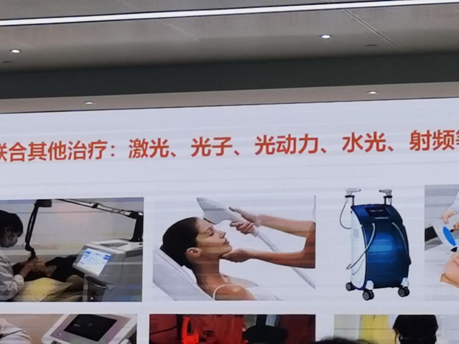 果酸脸部换肤,果酸化学换肤