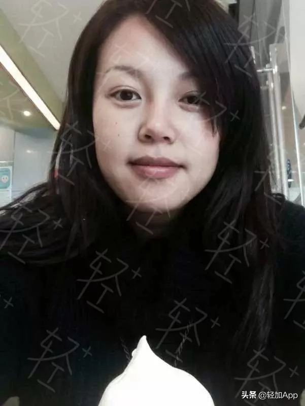 按摩减肥为啥能瘦下来,埋线减肥真的能瘦10斤吗