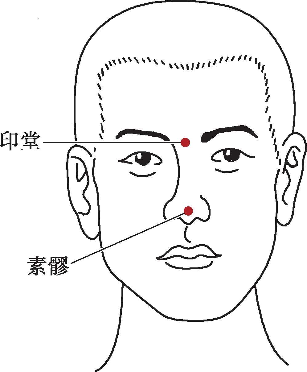 国医大师吕景山对穴：启闭醒脑开窍类印堂—上脘