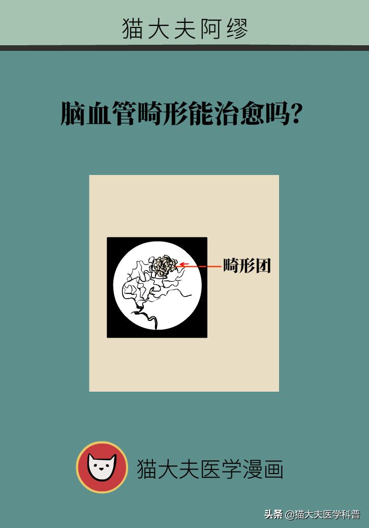 脑血管畸形在哪些部位比较严重,先天性脑血管畸形可以治愈吗