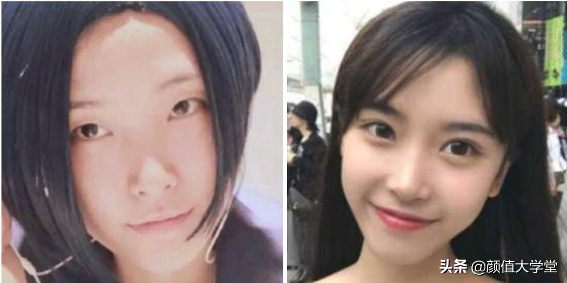 长期贴双眼皮的危害,贴几次双眼皮贴会导致眼皮松弛