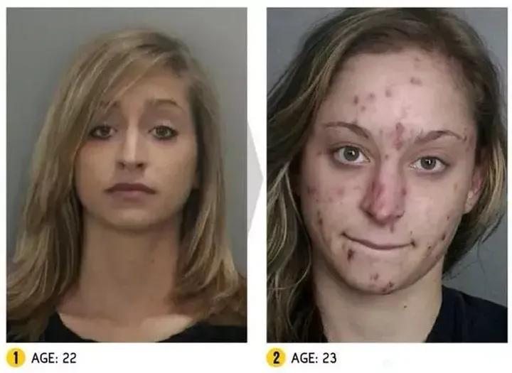 吸毒危害的科普小知识,吸毒太可怕请珍爱生命远离毒品