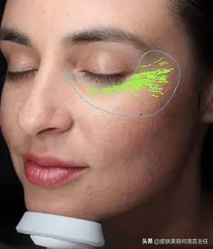 visia皮肤检测是什么原理,visia皮肤检测值多少是正常的