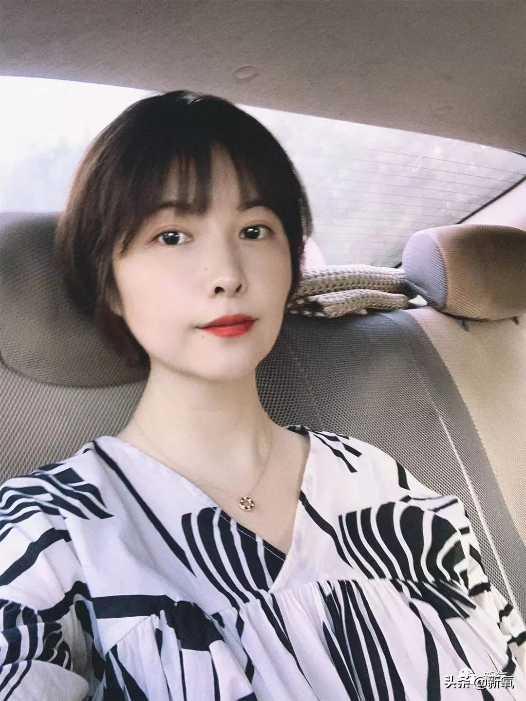 迷死氧亲身体验，我在日本吸掉了一桶脂肪和半张脸