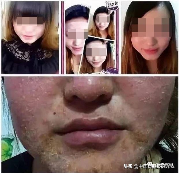 权健和tst,tst和权健