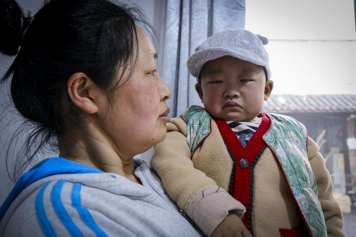 刚出生的小孩要换肝是什么病,小孩出生一星期眼睛黄